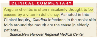 Vitamin Deficiencies Angular Cheilitis